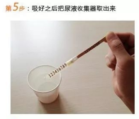 第5步：吸好之后把尿液收集器取出来