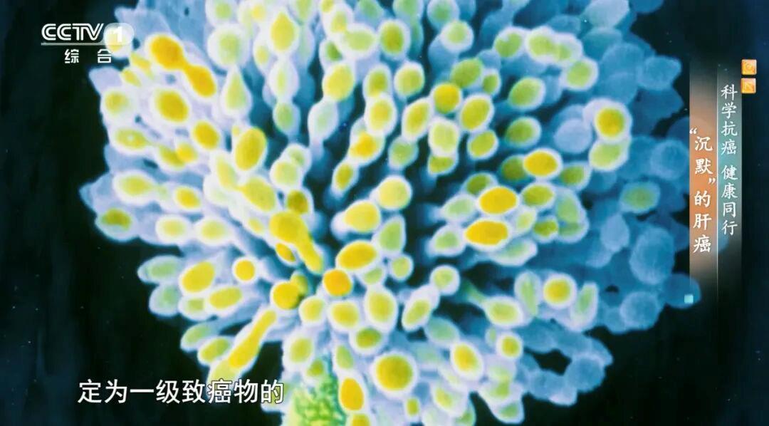 警惕肝脏的“隐形炸弹” 收好这份预防肝癌行动指南