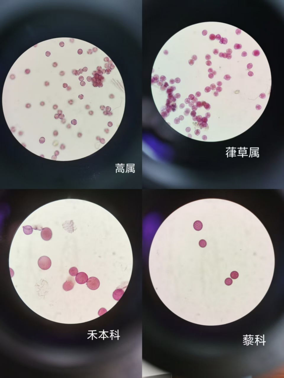 警惕秋季花粉来袭!科学防护远离过敏困扰 警惕秋季花粉来袭!科学防护远离过敏困扰